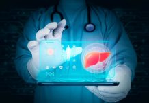 Gilead Acquisition of CymaBay Rekindles Interest in Liver Disease